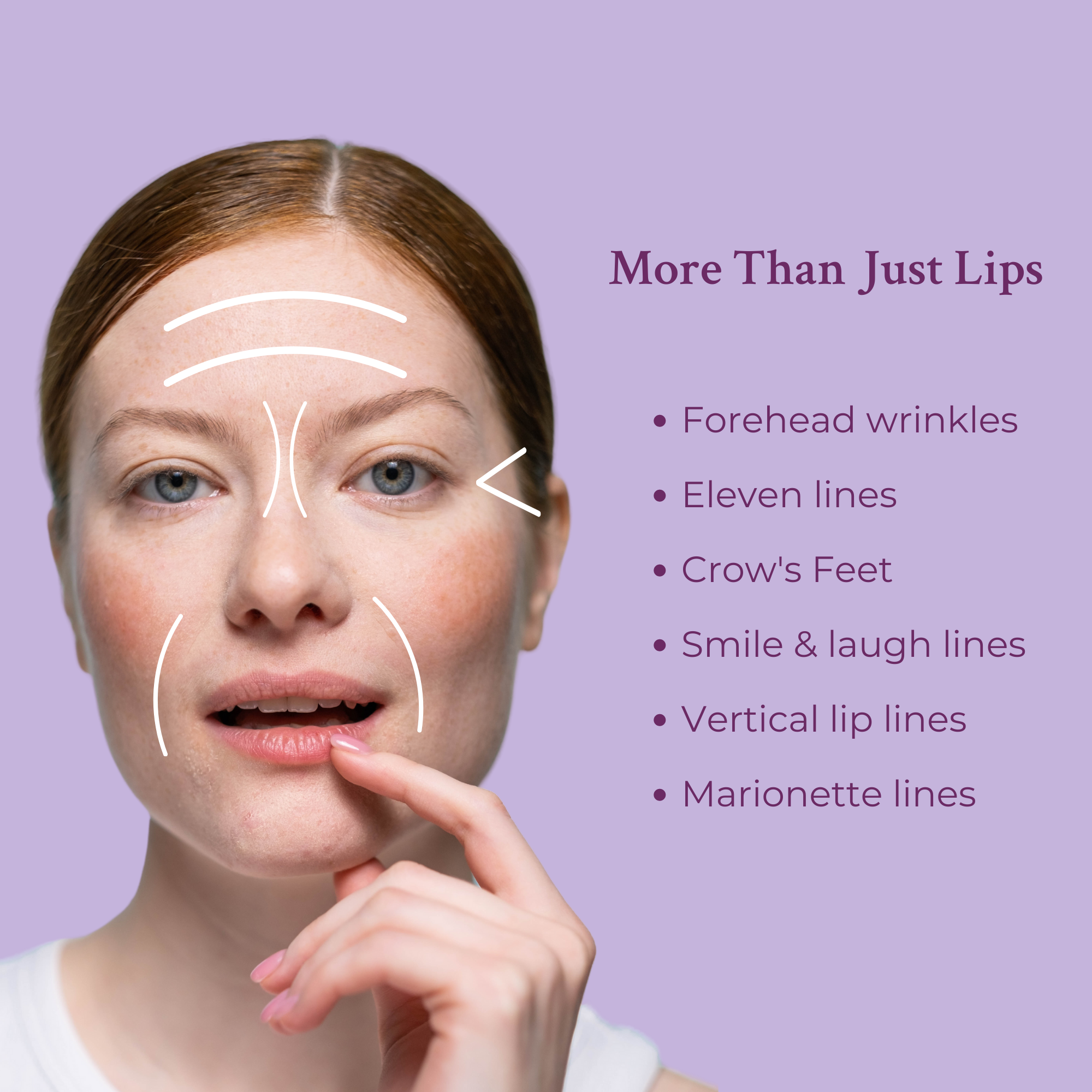 Ageless Lip &amp; Line Filler